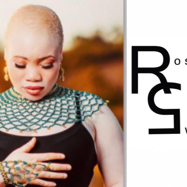 Albinism: Myths, misconceptions, discrimination and cultural beliefs
