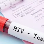 A file photo of HIV test cube taken a medical centre after the blood test of a patient.